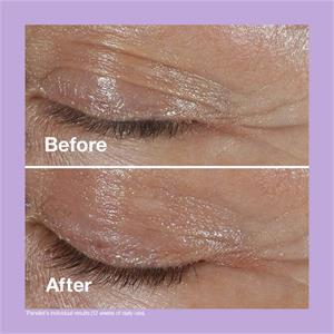 Clinique Smart Clinical Repair? Wrinkle Correcting Eye Cream 15ml